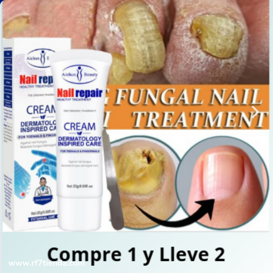 ELIMINA HONGOS DE UÑAS DE PIES Y MANOS